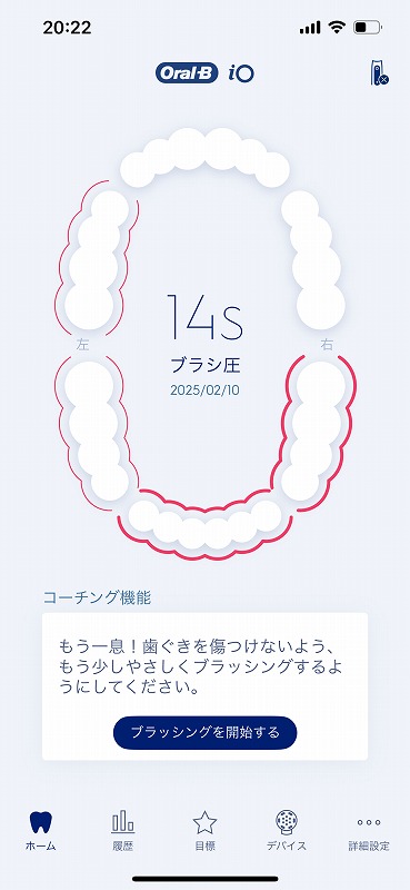アプリで磨き残しを確認している写真